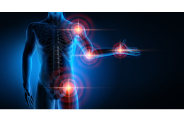 TENS Schmerztherapie: Anwendung & Erfahrung mit den Geräten für die transkutane elektrische Nervenstimulation