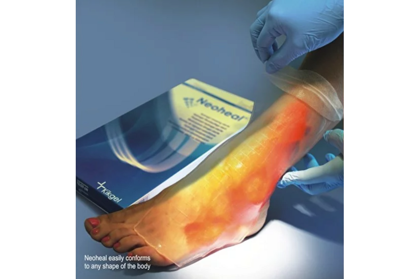Hydrogel-Wundauflage NEOHEAL