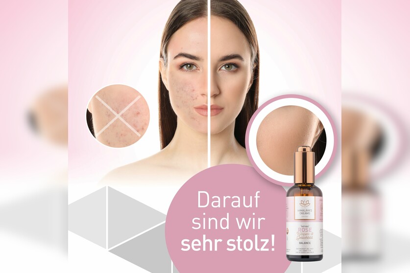 Ayurveda Körper- und Gesichtsöl Rose - Balance