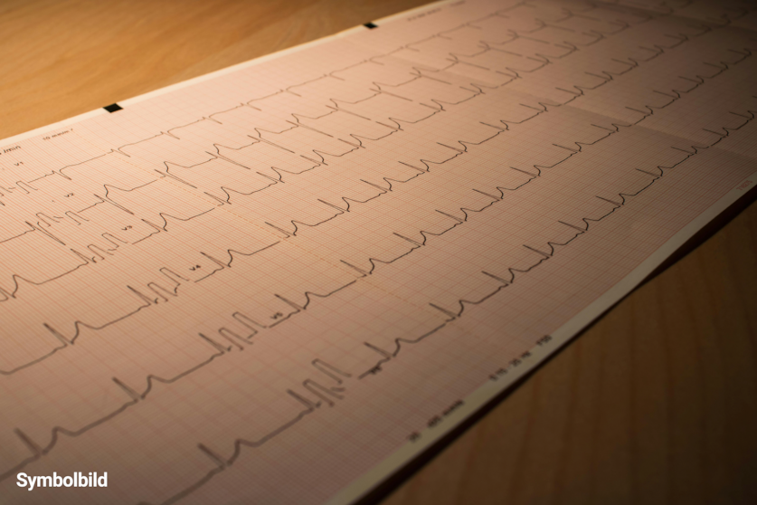 EKG-Faltpapier für Siemens Cardiostat 31/31S