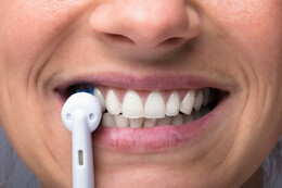 Zahnreinigung: Informationen und Tipps zur Erstattung &amp; Kosten&uuml;bernahme der Krankenkasse