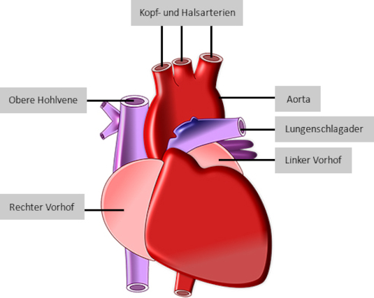 Herz, Aufbau, Darstellung, Herzinfarkt