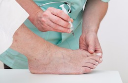 Hilfe bei Spreizfuß: Diese 10 Übungen für Fußgymnastik lindern Schmerzen Hilfe bei Spreizfuß: Diese 10 Übungen für Fußgymnastik lindern Schmerzen