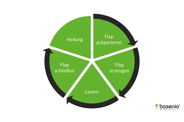 Augen lasern, femtolasik, Ablauf, Operation