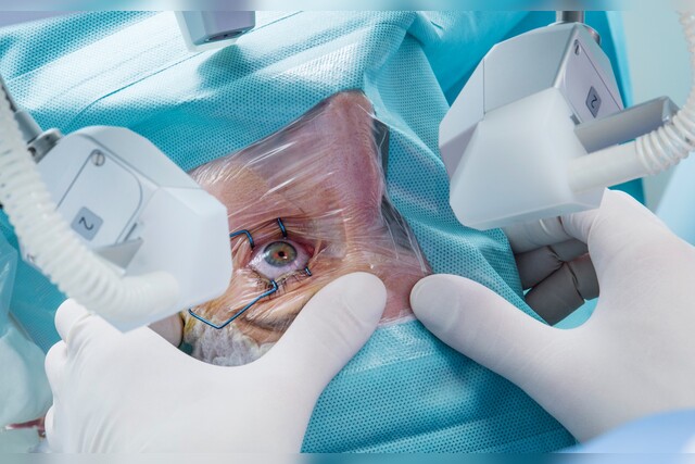 Augen-Op, Auge, Arzt, augen lasern