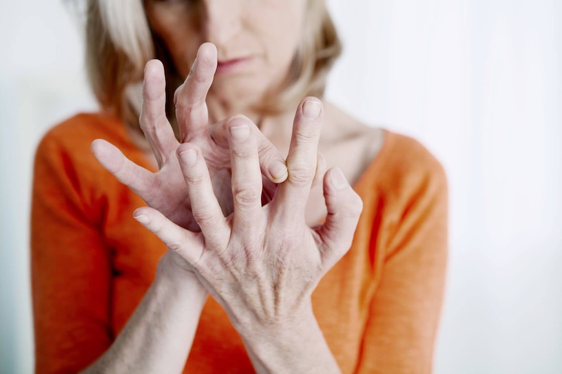 Ernährung bei Arthrose | richtige | vermeiden | Ernährungstherapie Bild zum Artikel: Ernährung bei Arthrose | richtige | vermeiden | Ernährungstherapie