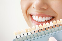 Bleaching Kosten: Preisvergleich für eine professionelle Zahnaufhellung