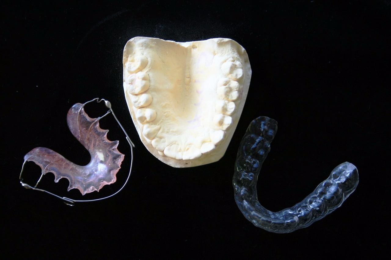 Zahnspange, Zahn, Zähne, Kieferorthopäde, Kieferorthopädie
